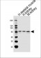 AMPD3 Antibody (Center)