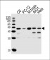 MEK1 (MAP2K1) Antibody (N-term)