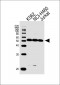 CHEK2 Antibody (N-term)