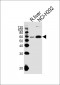 MCCC2 Antibody (Center)