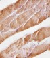 Musk Antibody