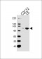 Musk Antibody