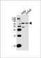 FOXO3 Antibody (N-term)