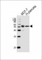 ESR2 Antibody(C-term)
