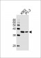 BBS5 Antibody (Center)
