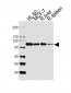 STAT5b Antibody (C-term)