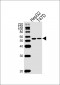 ALDH6A1 Antibody