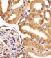 VEGFR3 Antibody