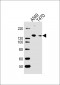 VEGFR3 Antibody