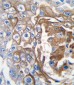 NRAS Antibody (C-term)