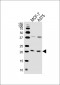 NRAS Antibody (C-term)