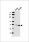 CAV2 Antibody (N-term)