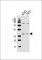 BCL2L11 Antibody (Center)