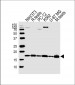UBE2L3 Antibody (C-term)