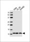 NDUA4 Antibody (C-term)