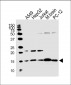 ATP5D Antibody (C-term)