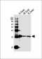 DECR1 Antibody (Center)