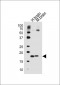 SNCA Antibody (C-term)