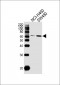 PPP2R1B Antibody (N-term)