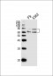 ASH2L Antibody (Center)