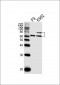 ASH2L Antibody (Center)