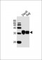 HLA-DRB1 Antibody (Center)