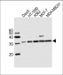 PNP Antibody (Center)