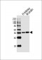 IHH Antibody (C-term)