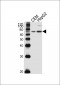 DYRK2 Antibody (N-term)