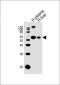 SERPINA1(Short peptide from AAT) Antibody (C-term)