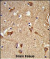 ALDH2 Antibody