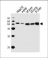 ALDH2 Antibody