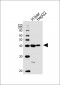 ACADSB Antibody (Center)