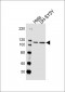 Mouse Ror2 Antibody (C-term)
