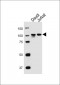 MME Antibody (Center)