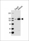 PTK2B Antibody (C-term)