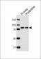 ENG Antibody (C-term)