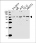 PAK1 Antibody (Center)