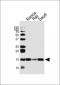 TCL1A Antibody (Center)