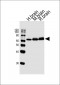 GLS2 Antibody (C-term E513)