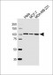 AFAP1-Y451 Antibody