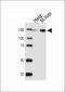 TYK2 Antibody (C-term)