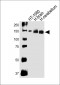 NCAM1 Antibody (C-term)