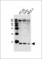 AGR2 Antibody (N-term)