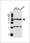 LYN Antibody (Center)