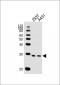 CHCHD3 Antibody (Center)