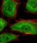 ACTL6A Antibody (Center)