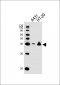 EPCAM Antibody (C-term)