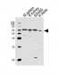 PPP2R1B Antibody (N-term)