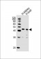 POU5F1B Antibody (C-term)